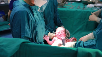 Țara care interzice nașterile prin cezariană. Motivele invocate de guvern